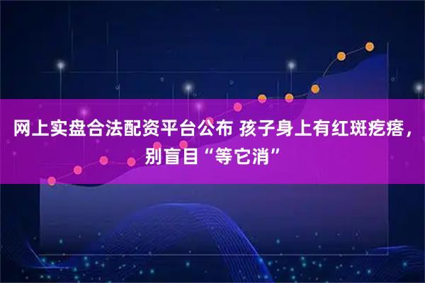 网上实盘合法配资平台公布 孩子身上有红斑疙瘩，别盲目“等它消”